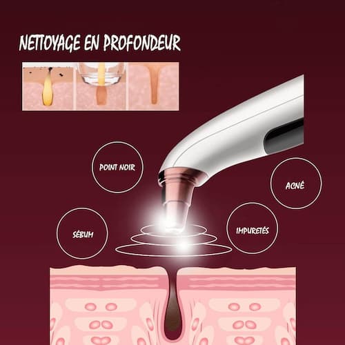 Aspirateur de points noirs