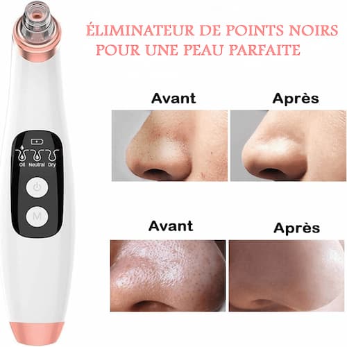 Aspirateur de points noirs